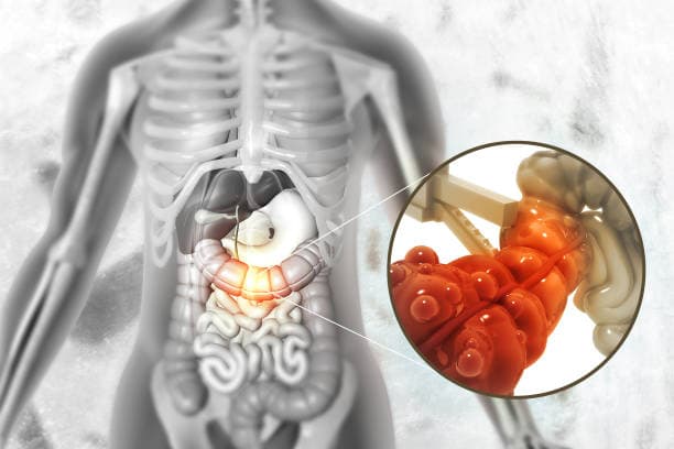 What is a nephrectomy?