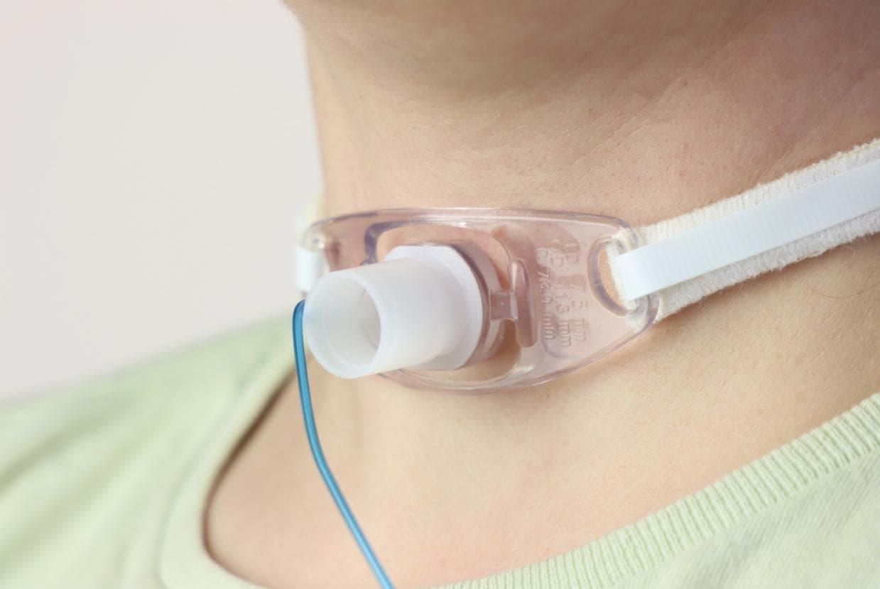 Who might need laryngectomy surgery?