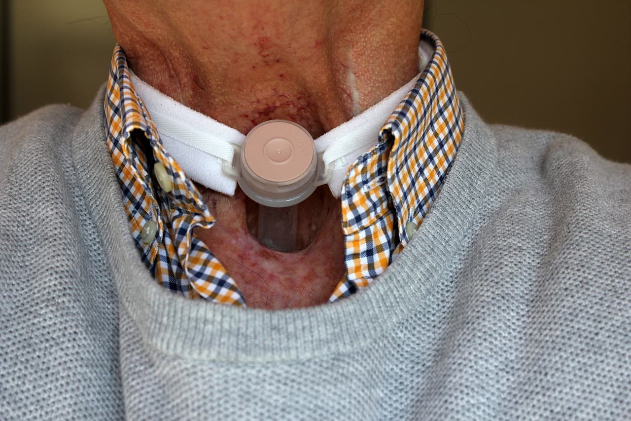 Laryngectomy risks