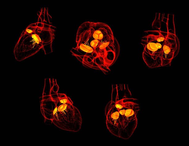 Should someone with congenital heart defects exercise?