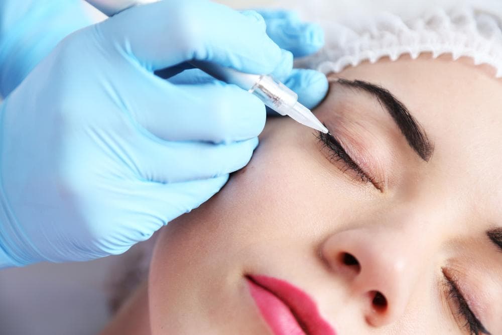 How to prepare for mesogel treatment?