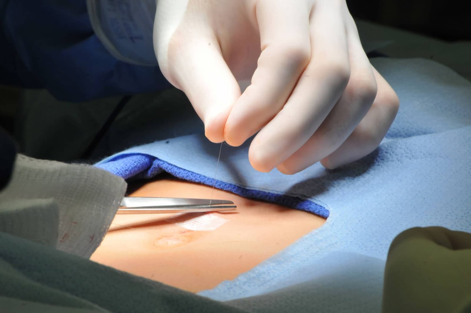 What are the benefits of hernia surgery?