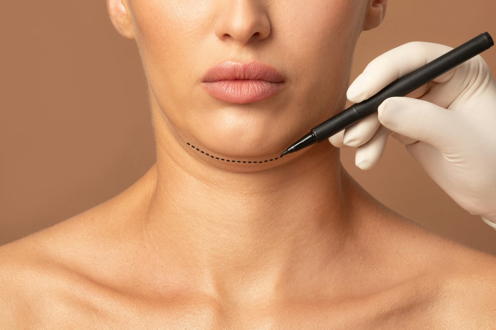 How is double chin suction done?