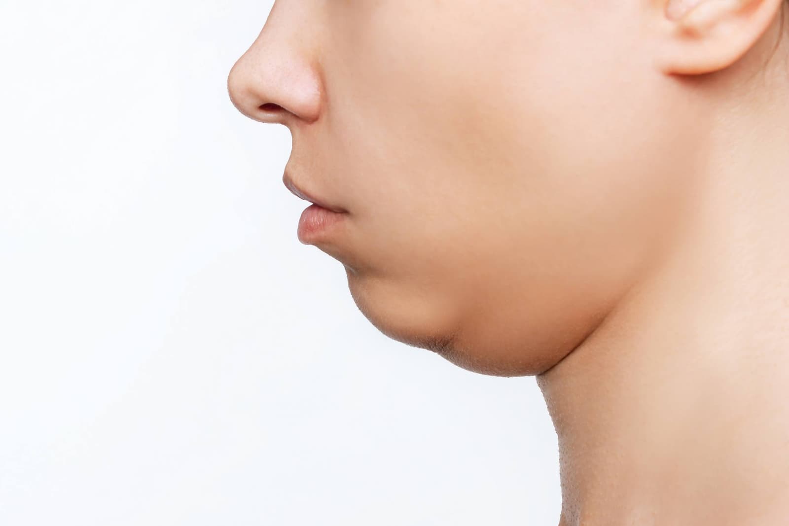Double chin surgery types