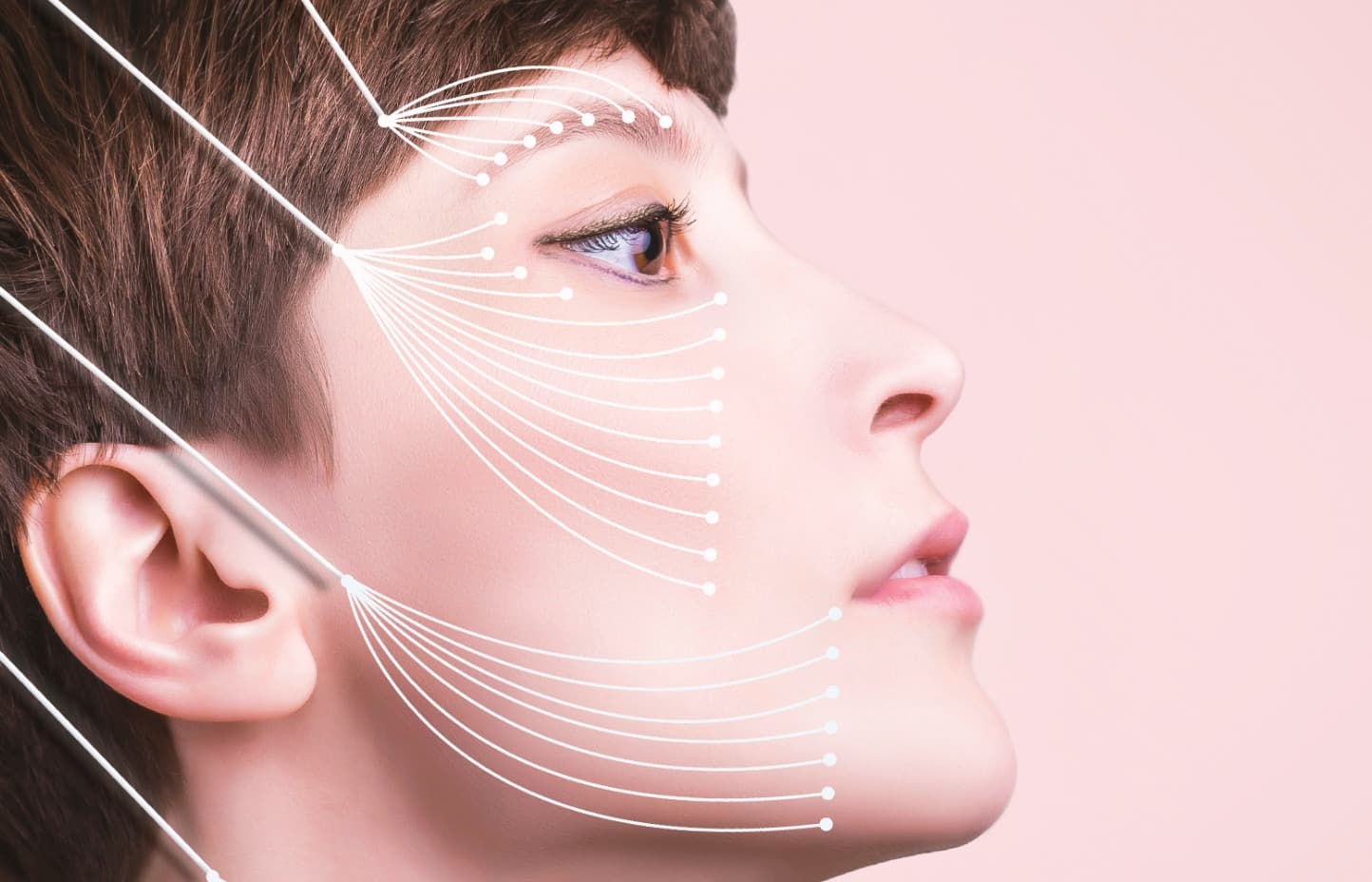 What are the risks & benefits of a thread lift?