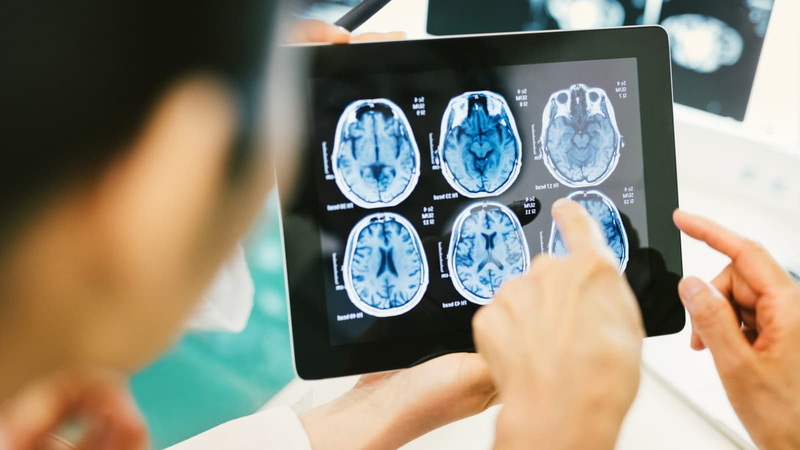 What are the neuro-ophthalmic conditions?