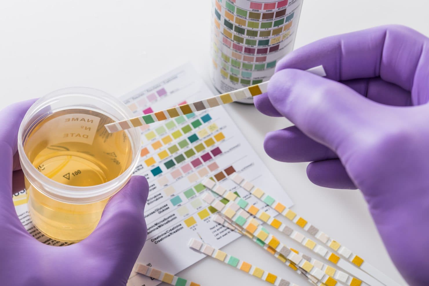 What are UTIs?