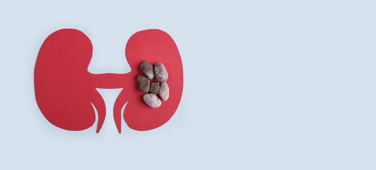 How are the kidney stones treated?