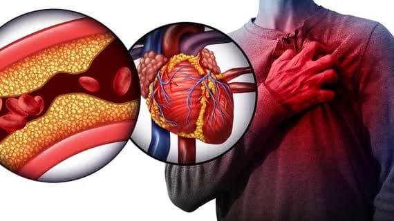 Cardiovascular Diseases