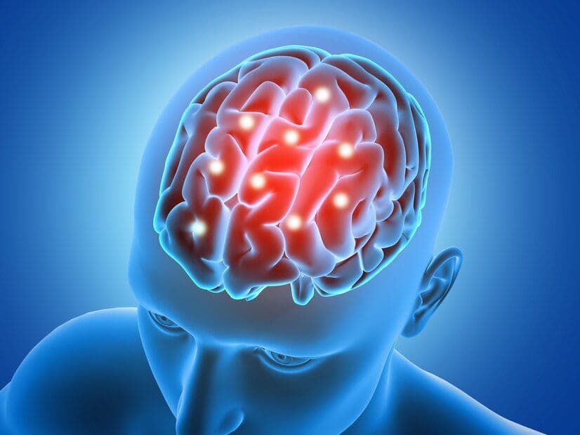 Neurological Disorders