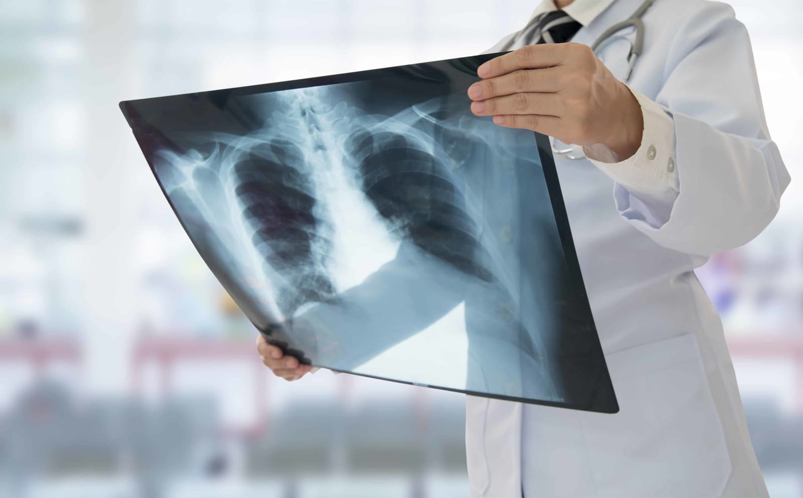 X-ray: What Happens During the Procedure?