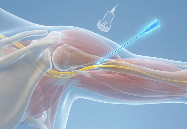 Common Causes of Peripheral Nerve Damage