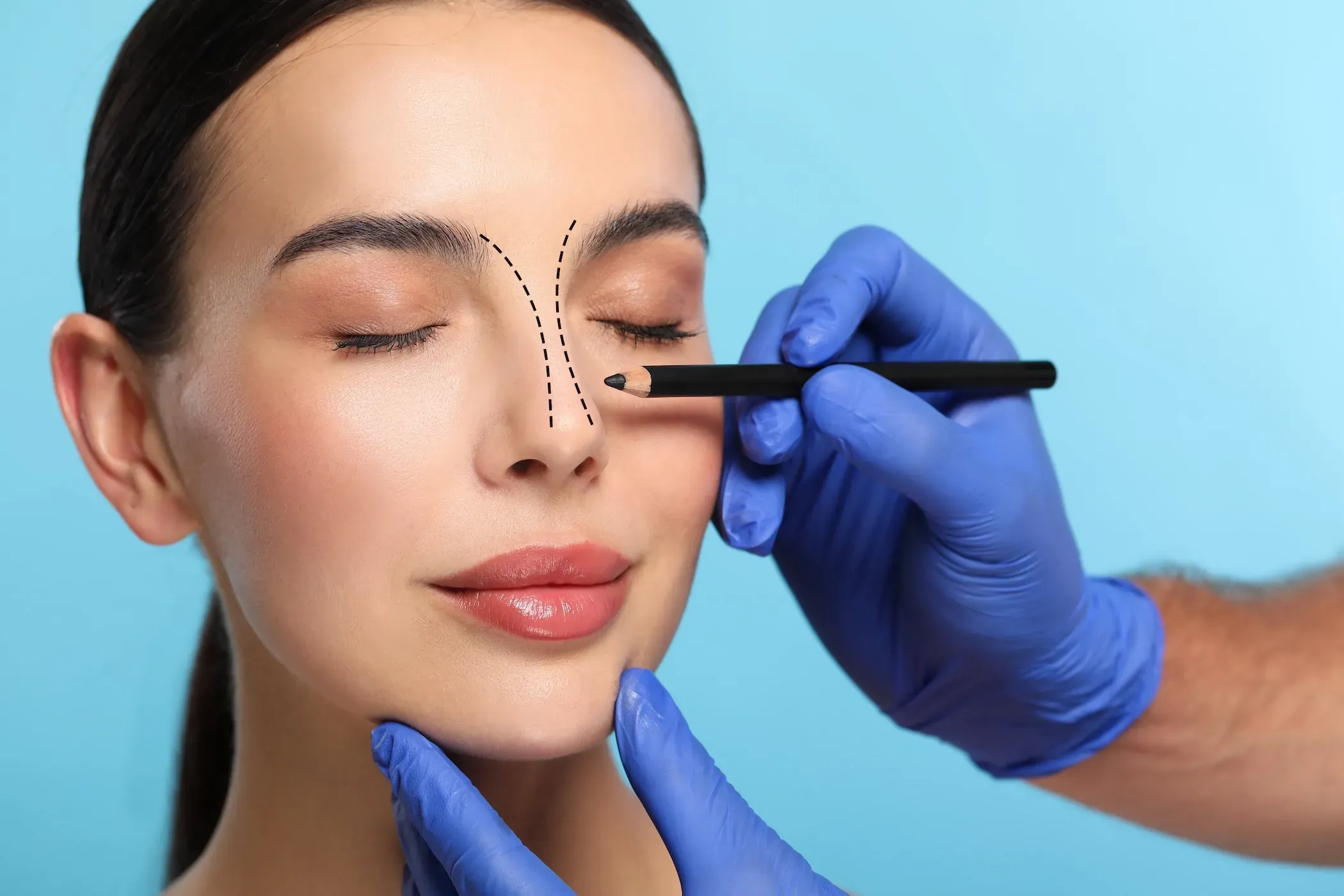 How Many Days Do You Need in Iran for Rhinoplasty a Day-by-Day Plan