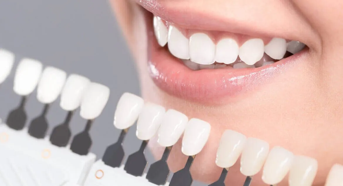 What problems can Dental Veneer fix?