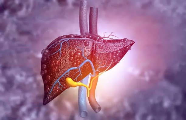 Why is a liver transplant performed?