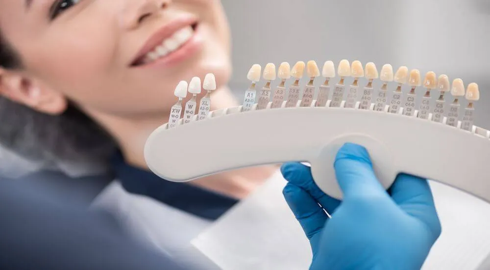 Dental Veneer procedure in Iran