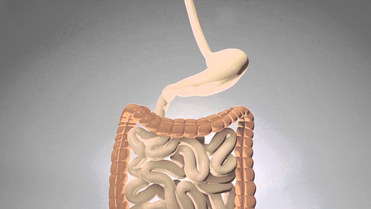 What is Gastrectomy surgery?